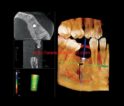 Anatomage In Vivo Viewer Download