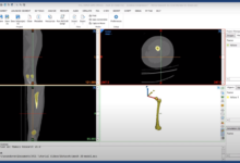 Materialise Mimics v26 + 3-matic v18-Software training,tutorials,download,torrent