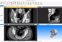 Synopsys Simpleware 2025.06-Software training,tutorials,download,torrent