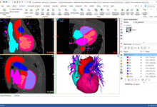 Materialise Mimics v29.1-Software training,tutorials,download,torrent